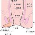 藏毛性疾病 藏毛性疾病