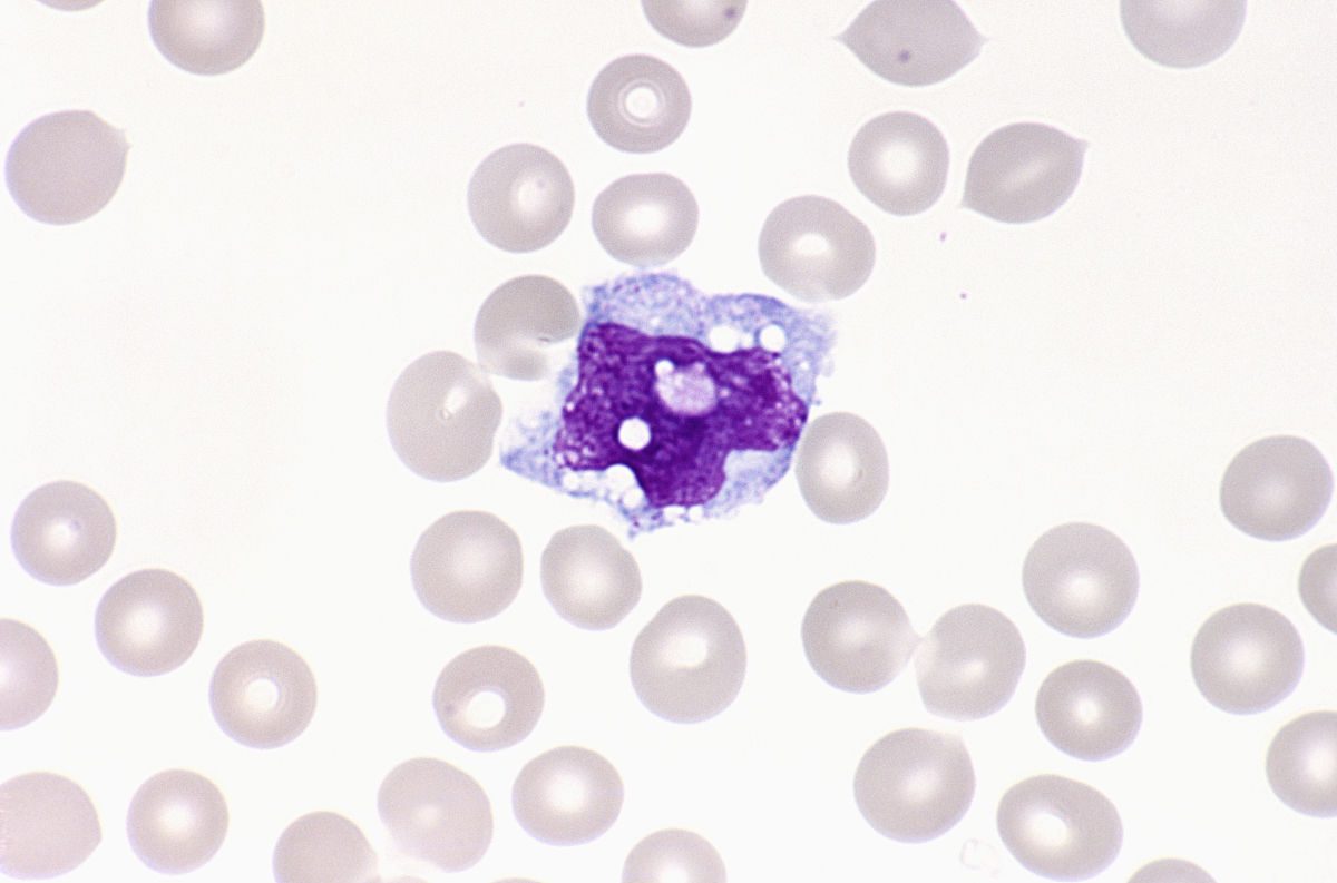 外周血單個核細胞