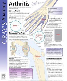 Arthritis(Dickson FRCP(Glas) FRCP(Lond) MRCGP, D. John著圖書) Arthritis(Dickson FRCP(Glas) FRCP(Lond) MRCGP, D. John著圖書)