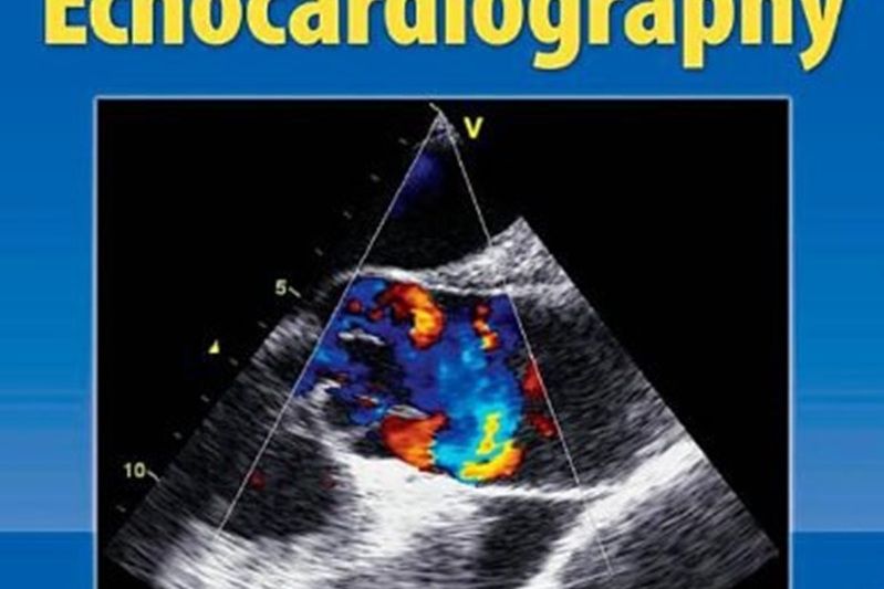 Complete Guide to Echocardiography Complete Guide to Echocardiography