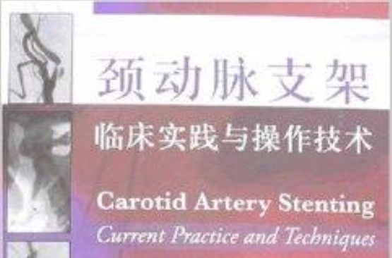 頸動脈支架臨床實踐與操作技術(頸動脈支架臨床實踐與操作技術（精）)