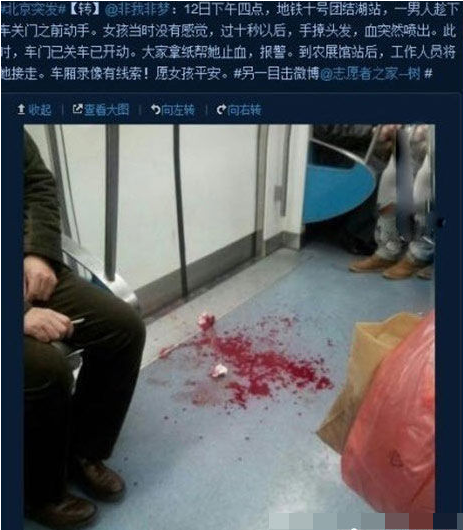 劃臉男 劃臉男