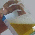 黏液尿 黏液尿