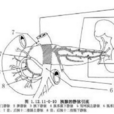 胰腺移植術 胰腺移植術