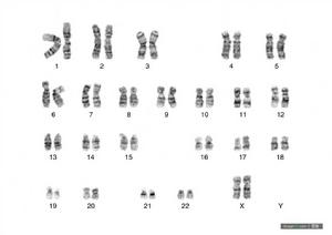 人類染色體圖片