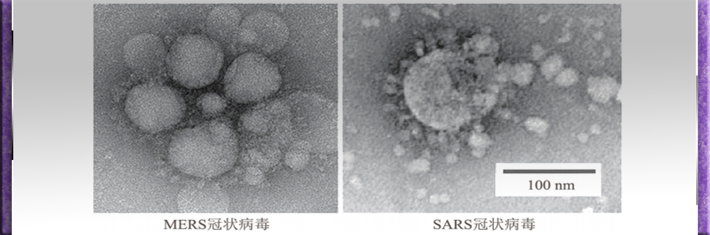 SARS冠狀病毒