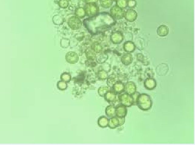 銅綠微囊藻