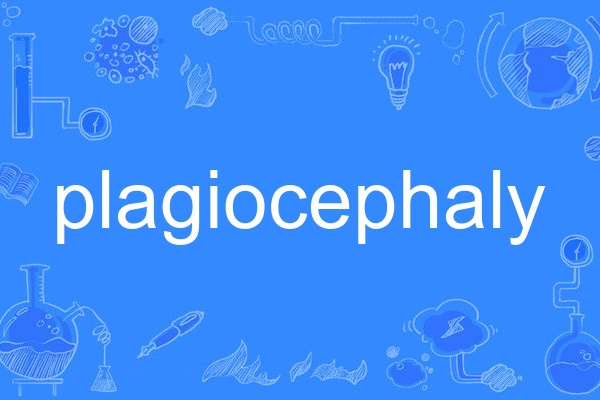 plagiocephaly plagiocephaly