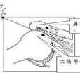 撞擊征