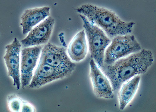 海拉細胞系(Hela細胞)