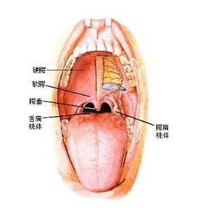 咽喉膿腫
