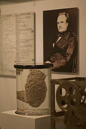 巴貝奇的大腦標本，在科學博物館展出。