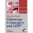 Step-by-step Colposcopy, Cryosurgery, and LEEP Step-by-step Colposcopy, Cryosurgery, and LEEP