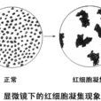 凝集反應