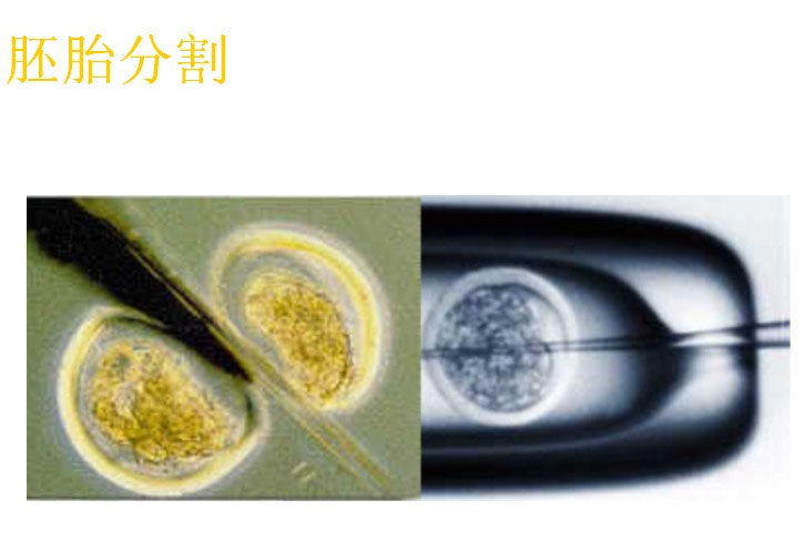 胚胎分割