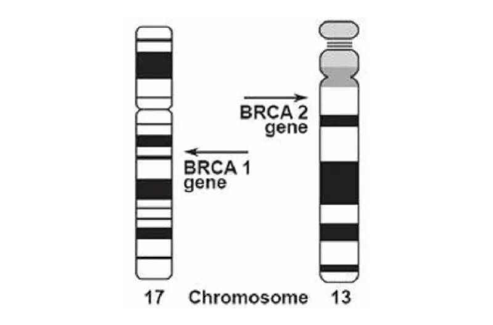 BRCA1基因