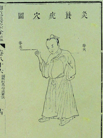 灸贅疣 灸贅疣