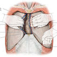胸膜間皮瘤