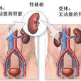 腎移植術後 腎移植術後