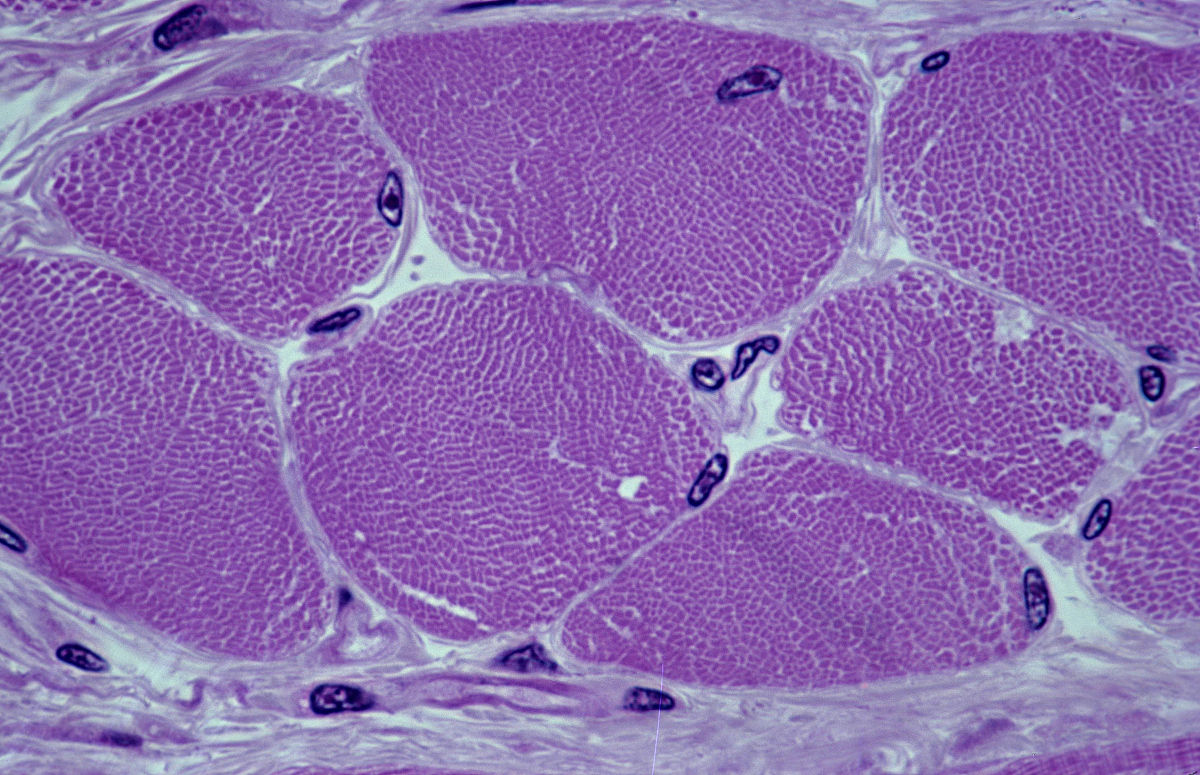 肌纖維細胞生長因子