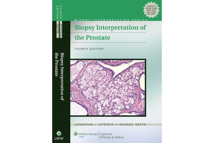 Biopsy Interpretation of the Prostate Biopsy Interpretation of the Prostate