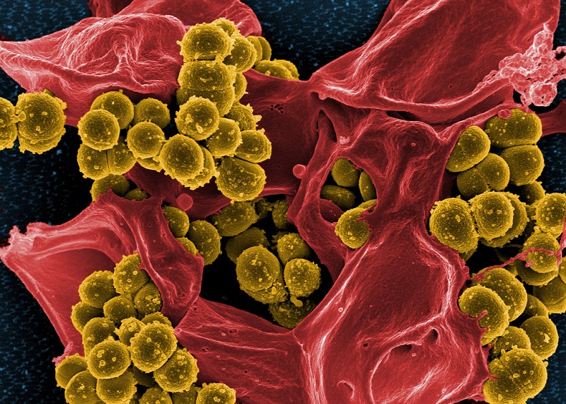 耐藥性金黃色葡萄球菌