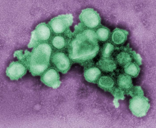 甲型H1N1流感病毒(H1N1亞型豬流感病毒)