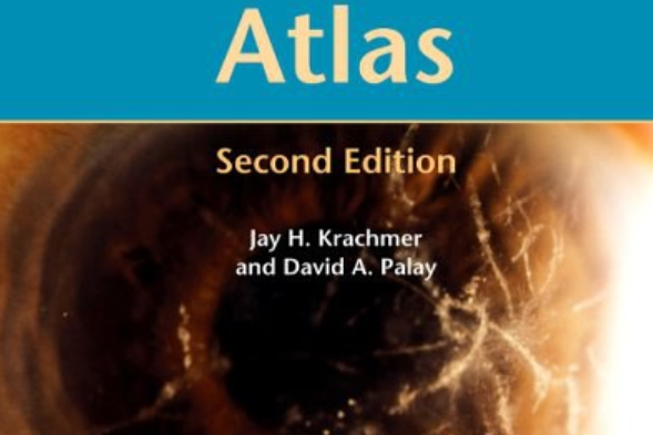 Cornea Atlas Cornea Atlas