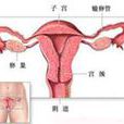 輸卵管腫大 輸卵管腫大
