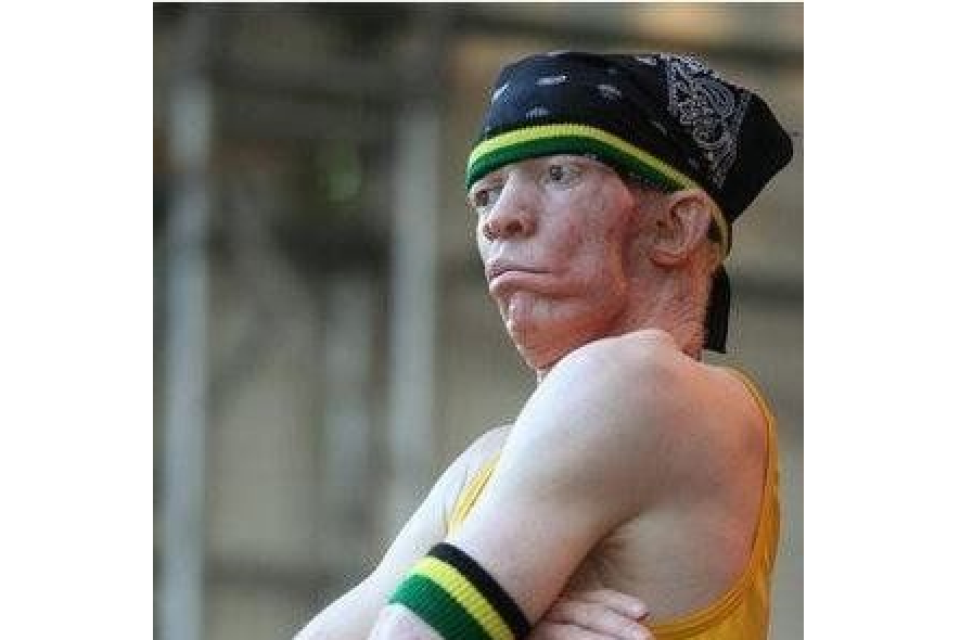 Yellowman Yellowman