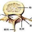 脊柱破壞 脊柱破壞
