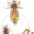 人虱 人虱