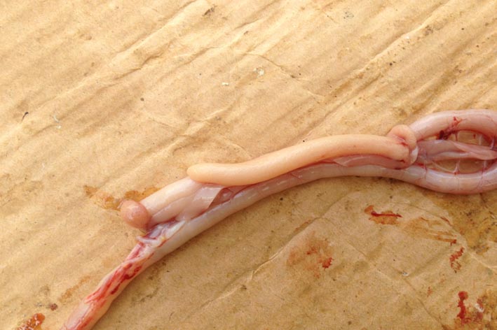 慢性小腸球蟲腸管粗細不勻，剪開外翻