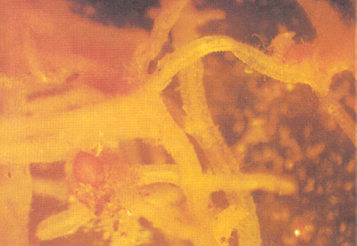 小麥禾穀胞囊線蟲病病根上的胞囊