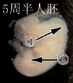 5周人胚胎