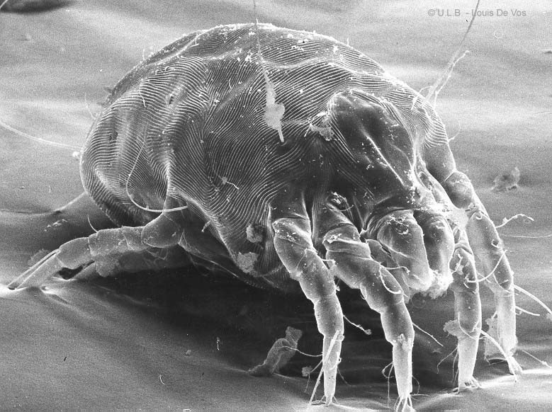 顯微鏡下的蟎蟲