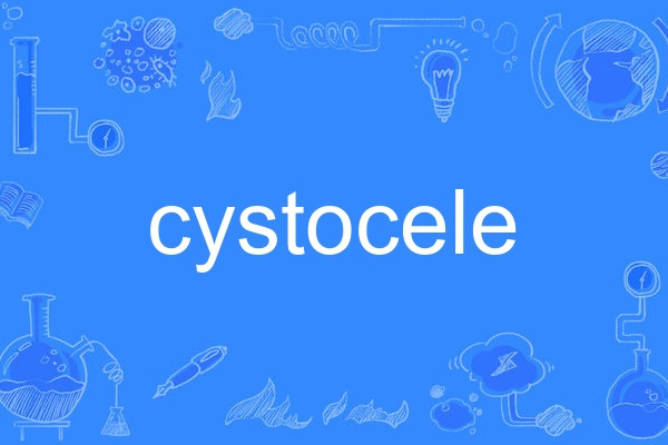 cystocele cystocele