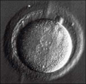 胚胎映射