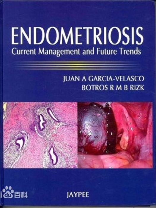Endometriosis Current Management and Future Trends Endometriosis Current Management and Future Trends