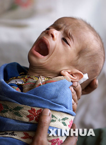 營養不良的阿富汗嬰兒在母親懷中哭泣