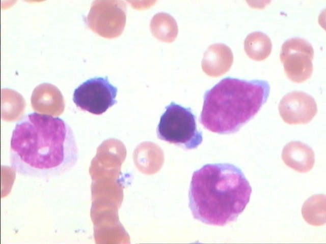 淋巴細胞