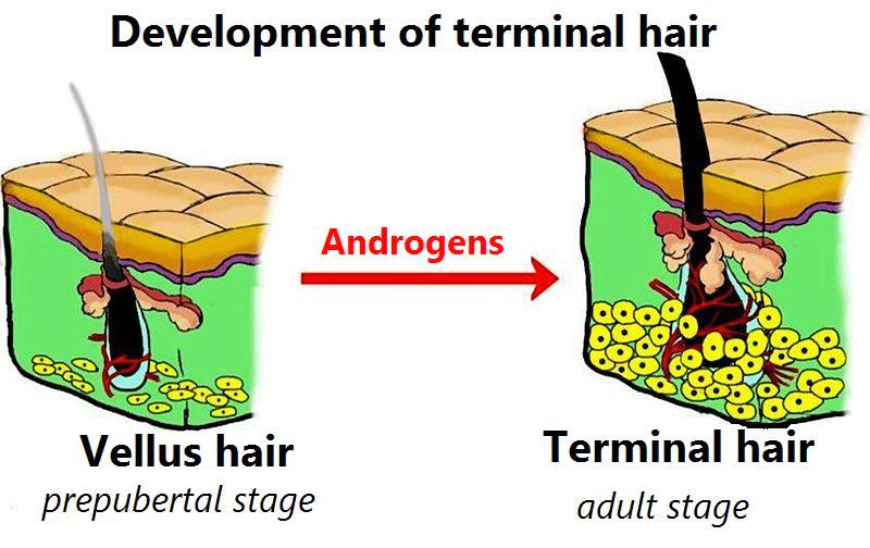 雄性激素作用下，毫毛向成熟體毛的轉化