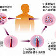 自體幹細胞移植