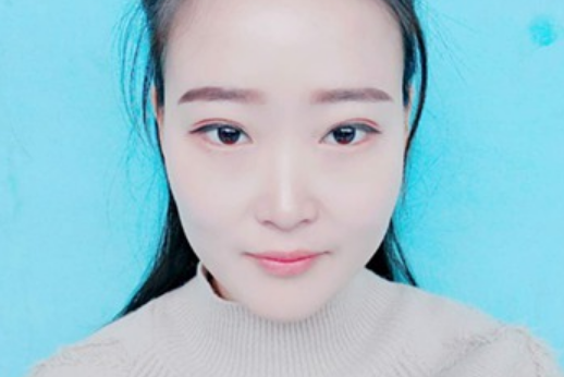 赤曉瑞