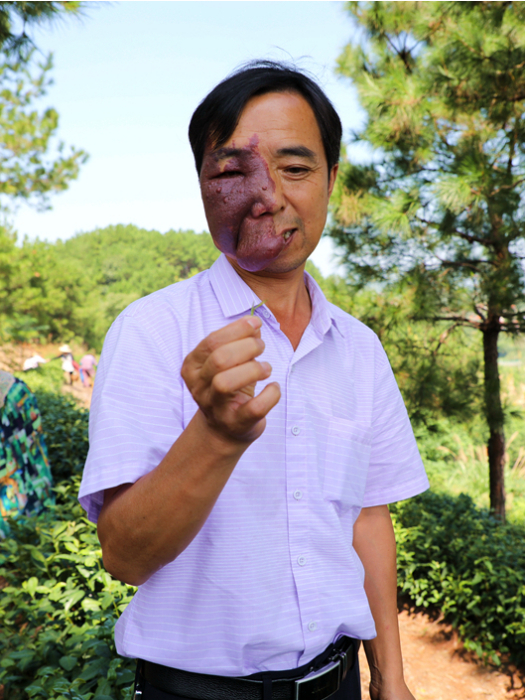 徐從德(2017年度中國殘疾人事業新聞人物) 徐從德(2017年度中國殘疾人事業新聞人物)