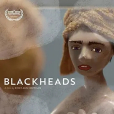 Blackheads Blackheads