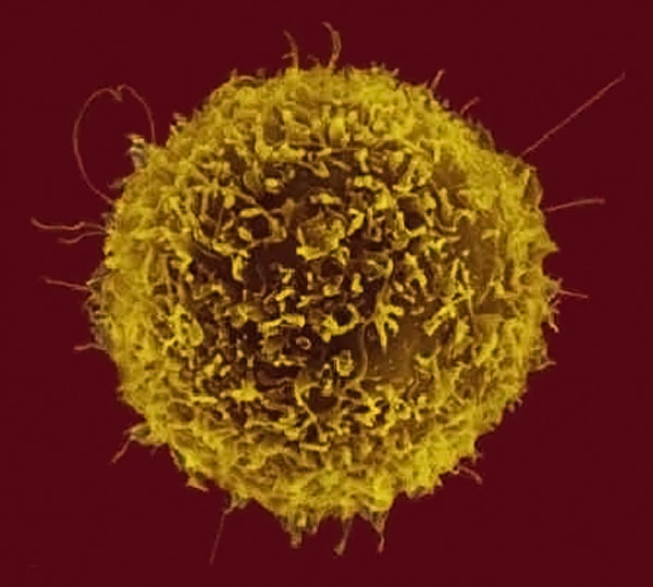 B淋巴細胞(B細胞)