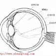 玻璃體渾濁 玻璃體渾濁