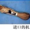 肌電假手 肌電假手