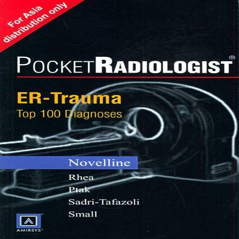 Pocketradiologist:ER-trauma top 100 diagnoses Pocketradiologist:ER-trauma top 100 diagnoses